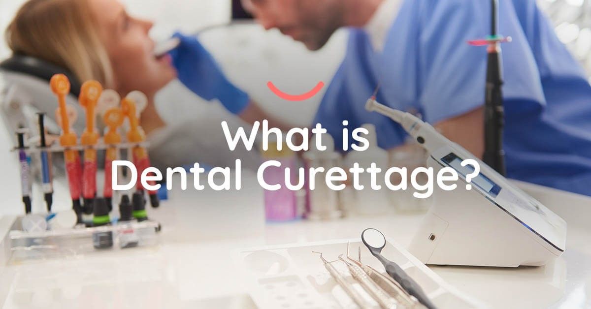 Dental Curettage What You Need to Know 🦷