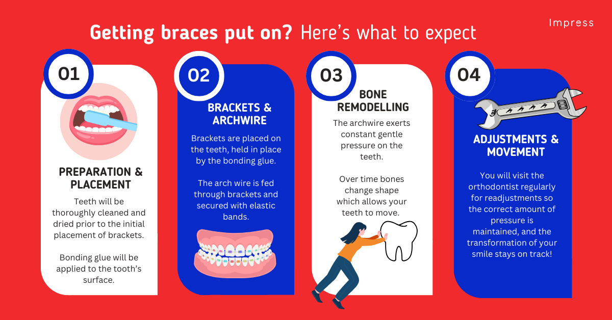 Braces fitting, infographic of step-by-step