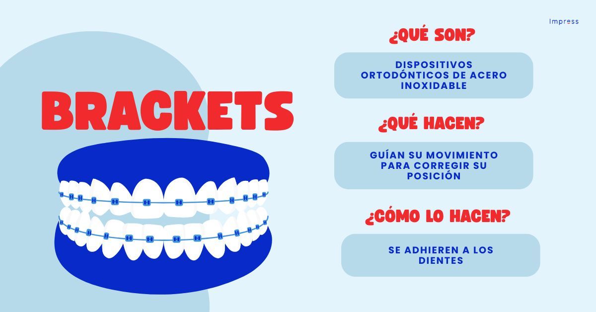 Infografía sobre qué son los brackets, qué hacen y cómo lo hacen.