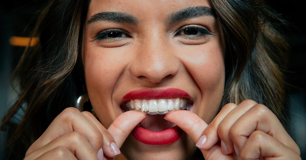 Una chica con alineadores invisibles de Impress que sirven para corregir el diastema.