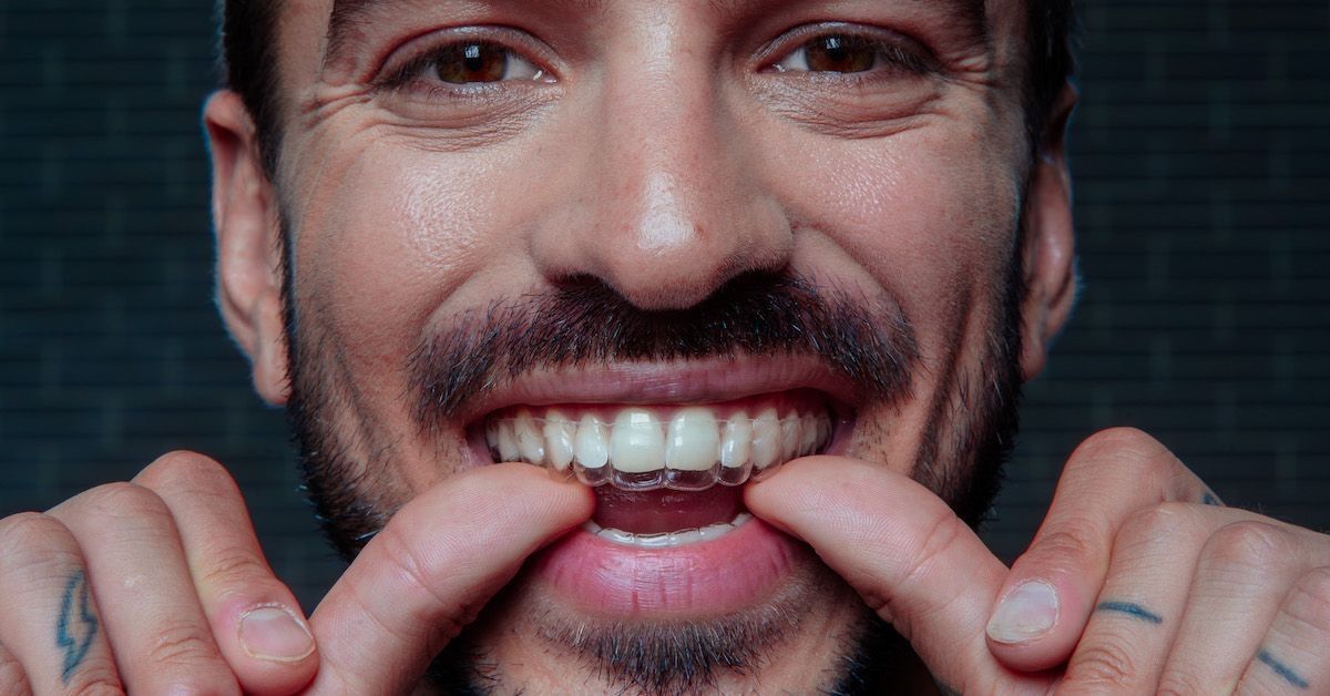 Man lachend met een aligner is zijn mond