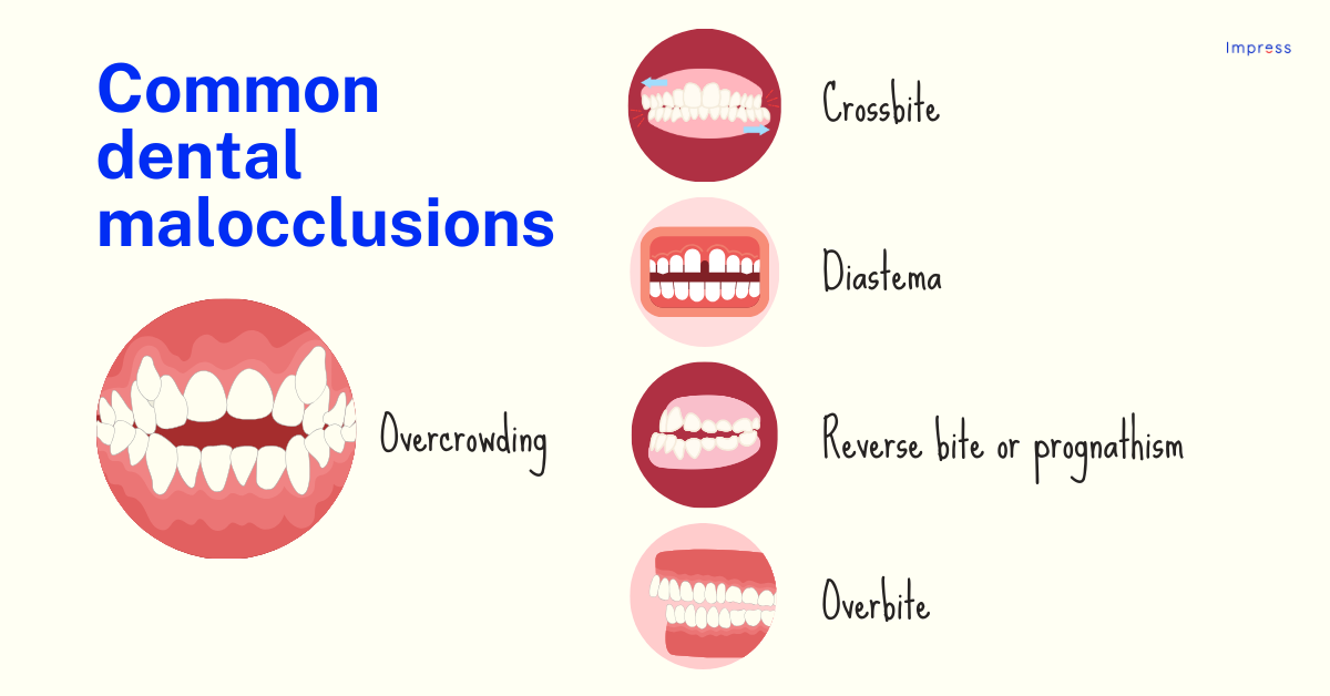 Types of malocclusions