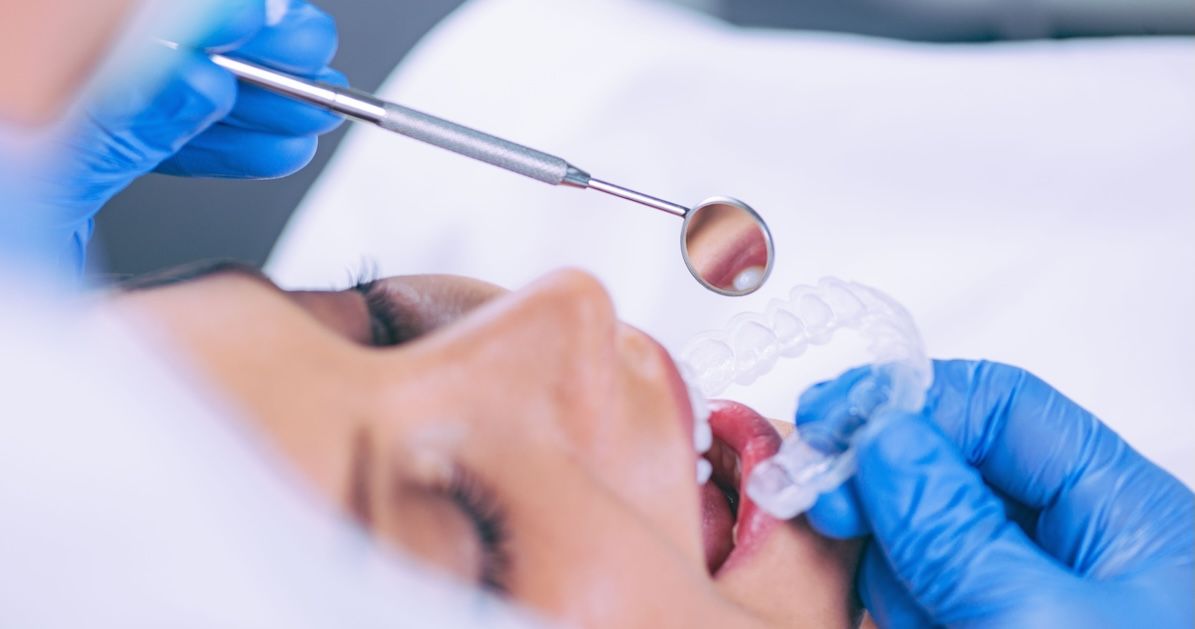 tandarts doet met een spiegel de onzichtbare beugel in patient haar mond