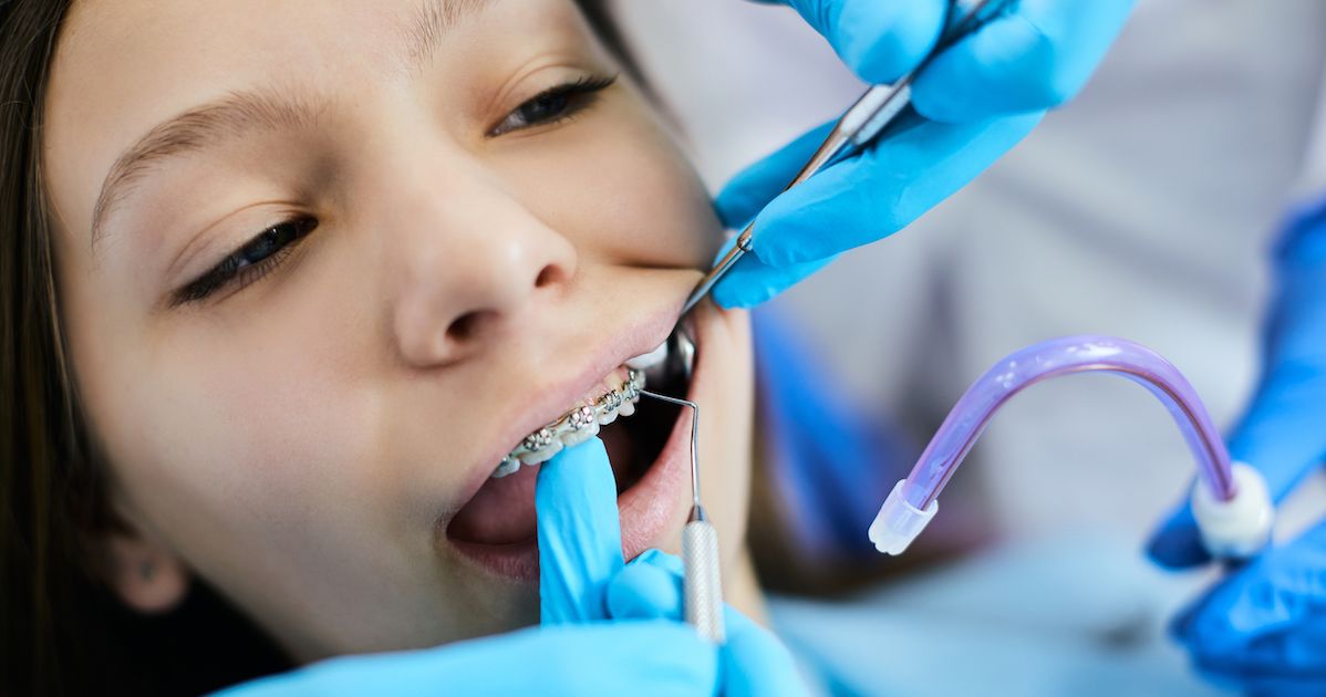 Apparecchio Dentale Invisibile : Denti Dritti Senza Imbarazzo | Studio - Foto 11