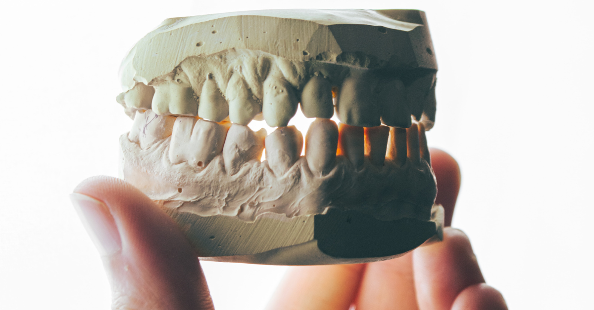 Een hand die een kaakvorm vasthoudt