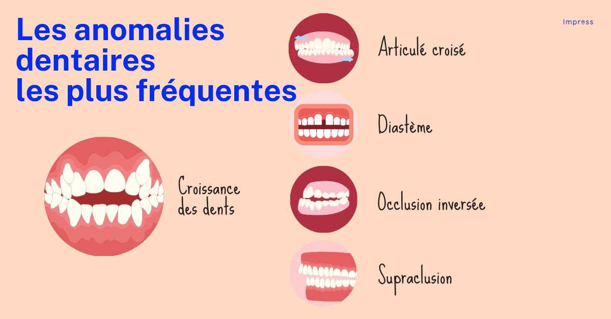 Infographie des anomalies dentaires les plus courantes