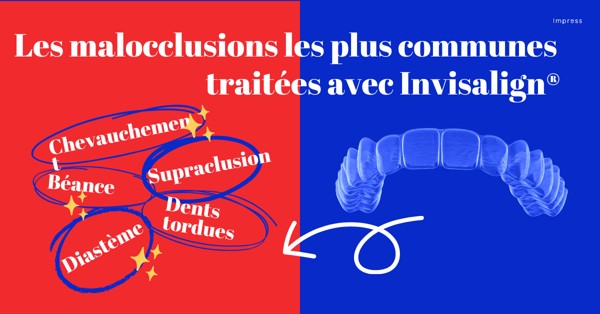 L'illustration montre les malocclusions les plus fréquentes que les aligneurs dentaires&nbsp;Invisalign® (obtenus grâce à Impress) peuvent corriger. Cela inclue les diastèmes, les supraclusions, les dents tordues ou les béances.