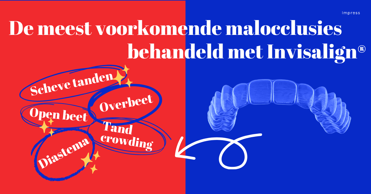 infographic van maloccluisies