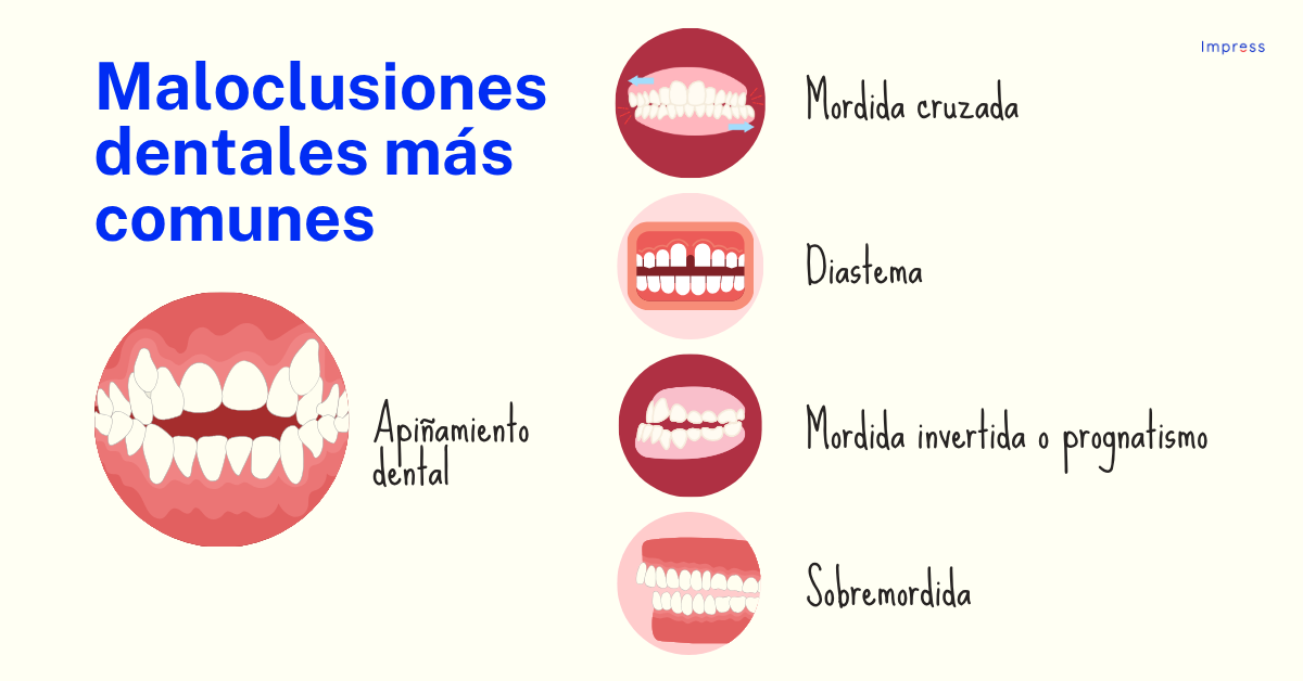 Tipos de maloclusiones dentales más comunes.