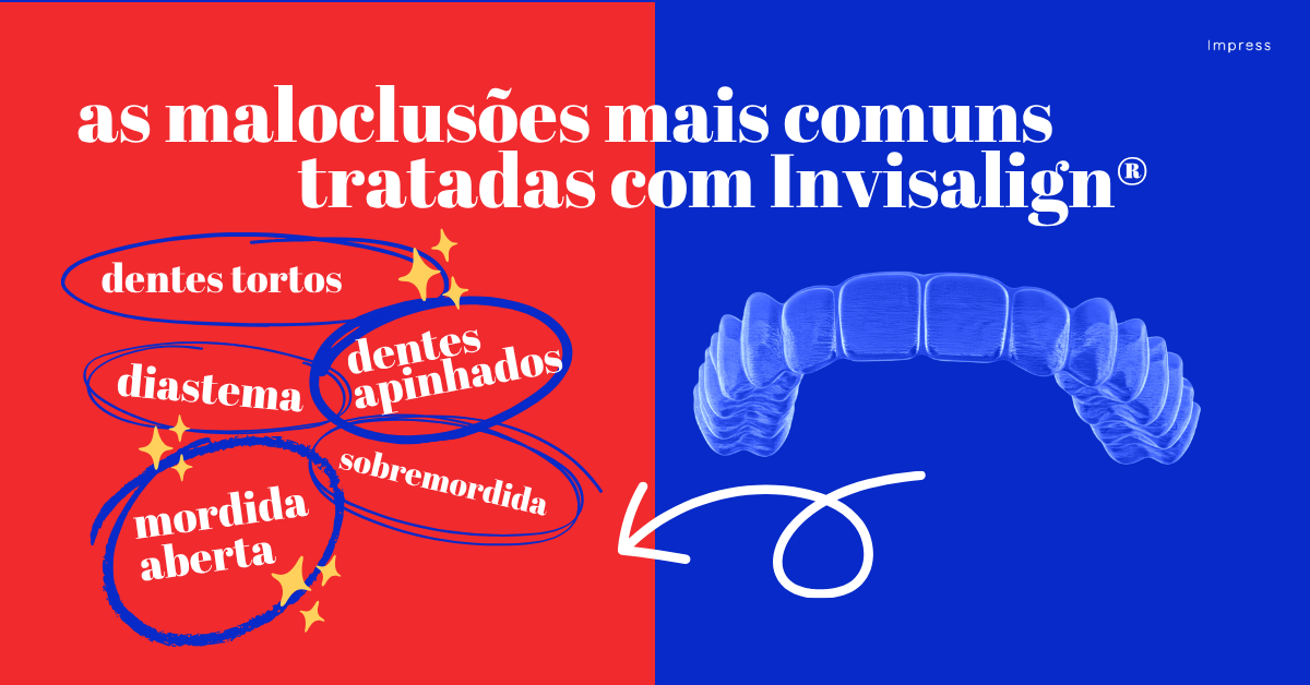 Os gráficos mostram as maloclusões mais comuns que os alinhadores Invisalign ajudam a tratar. Estas incluem dentes tortos, dentes apinhados, diastema, sobremordida e mordida aberta.