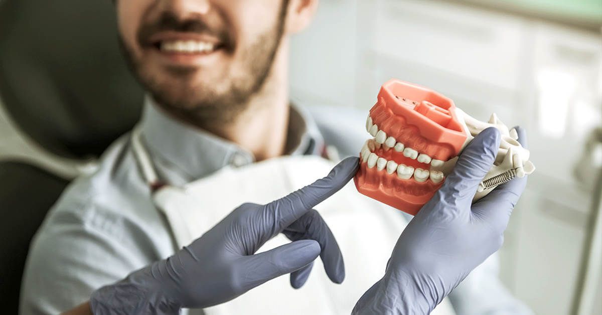 Staffe Autoleganti In Metallo Ortodontico All'ingrosso - Foto 2