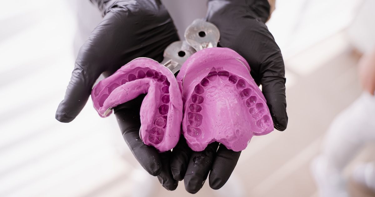 traditionele tandafdruk met pasta of silicoon