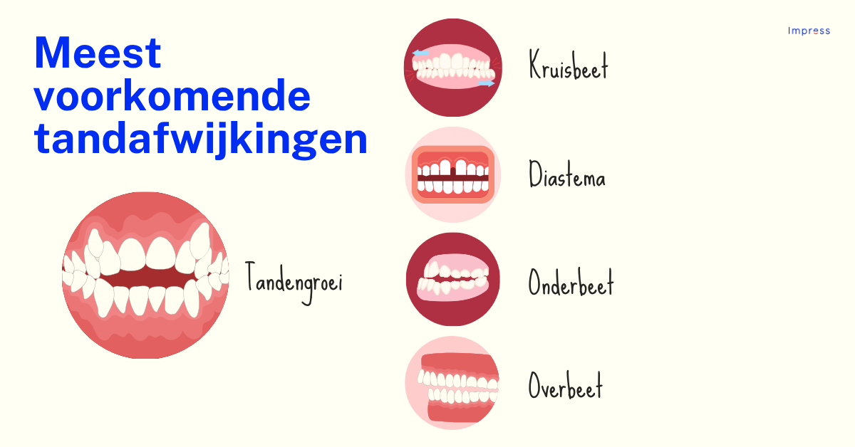 Infographic meest voorkomende tandafwijkingen
