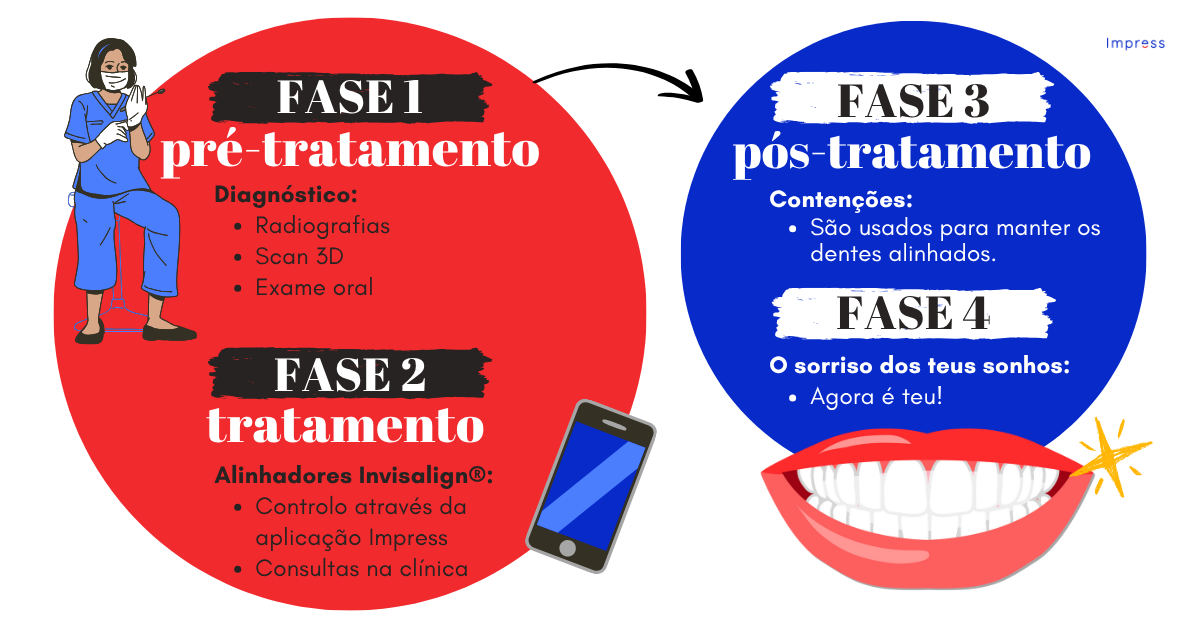 Como funciona um tratamento dentário Impress com alinhadores Invisalign. Fase 1, pré-tratamento com diagnóstico. Fase 2, tratamento com alinhadores Invisalign e a aplicação Impress para otimizar o acompanhamento do teu tratamento. Fase 3, pós-tratamento, com solução de retenção para manter o teu novo sorriso. Fase 4, desfrute do teu sorriso!