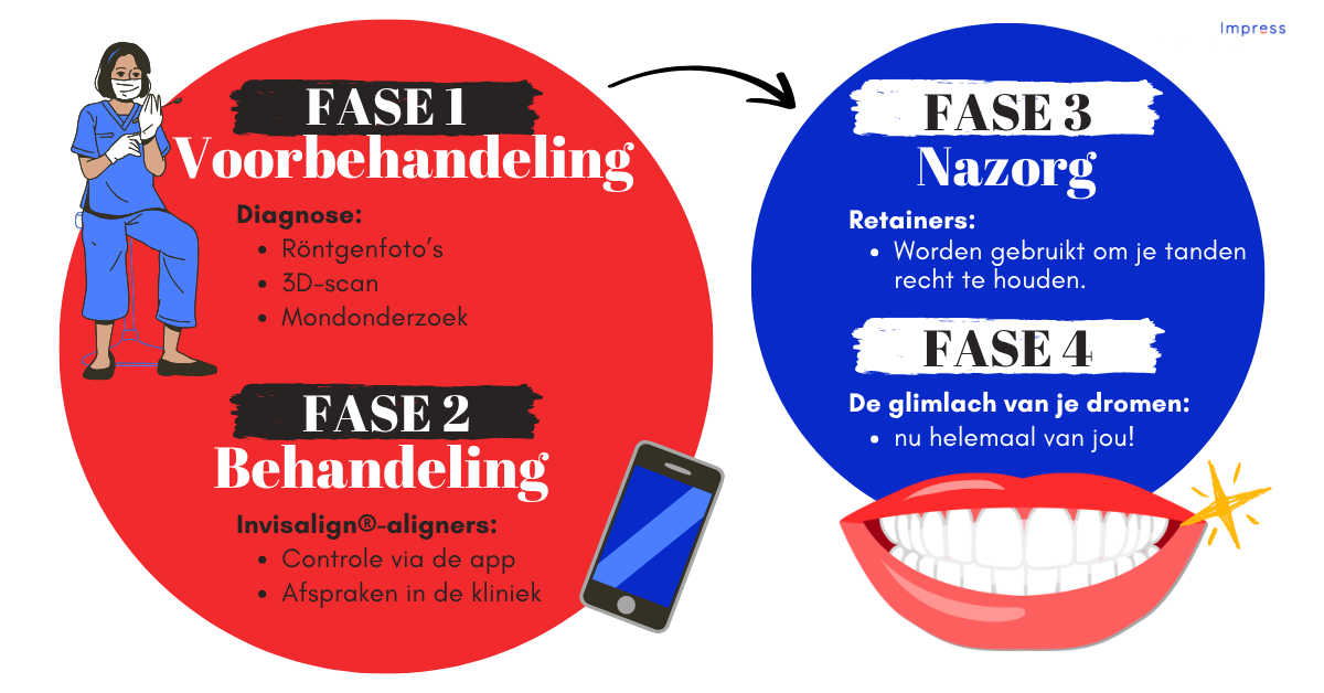 Infographic over de 4 fasen van een behandeling met onzichtbare beugel