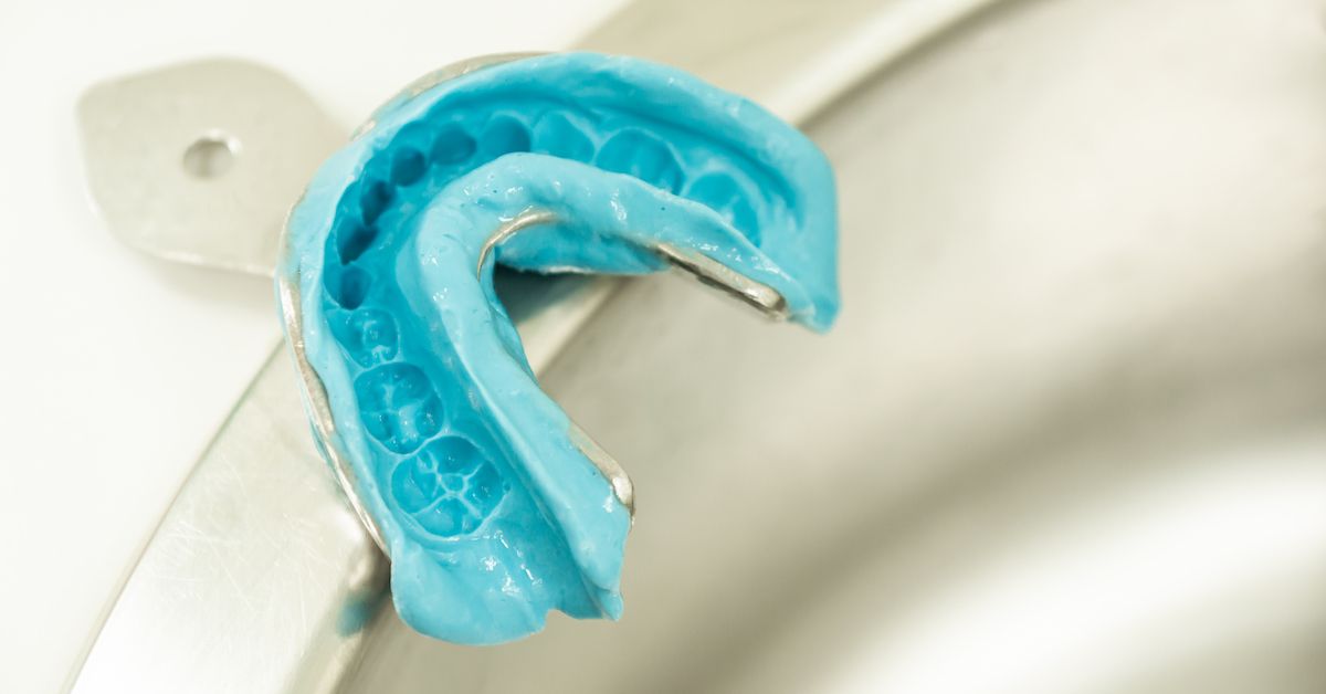 Un'impronta dentale realizzata con pasta o silicone.