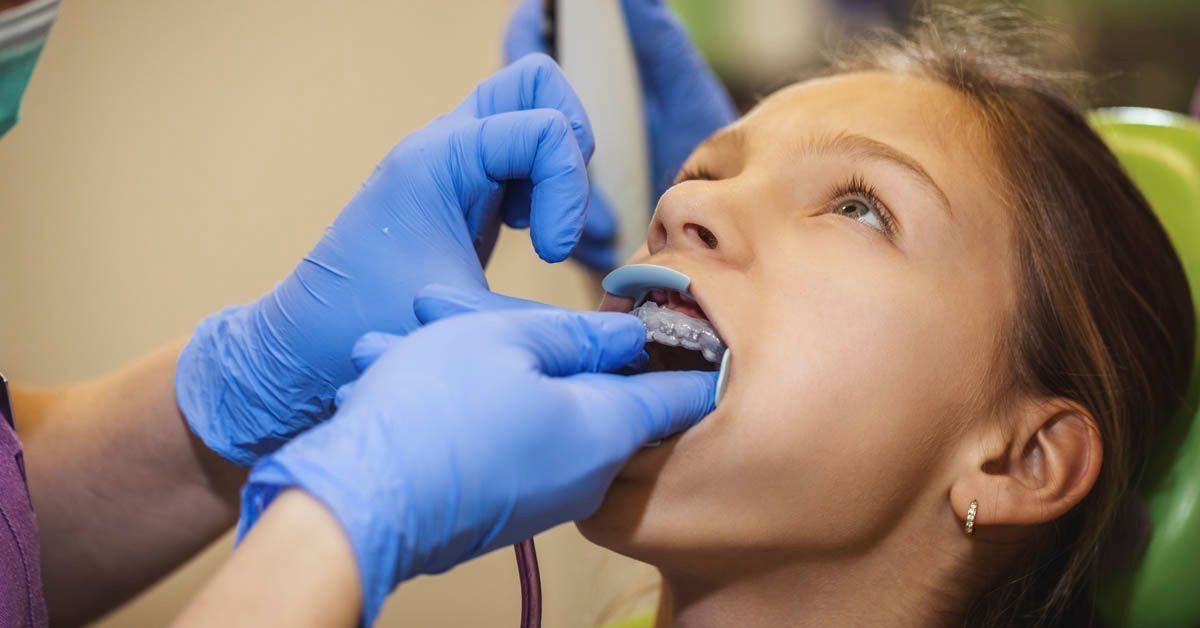 Beeld van het plaatsen van een beugel bij een patiënt