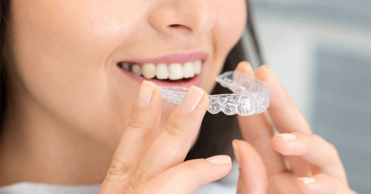 Close up of patient putting in invisible aligner