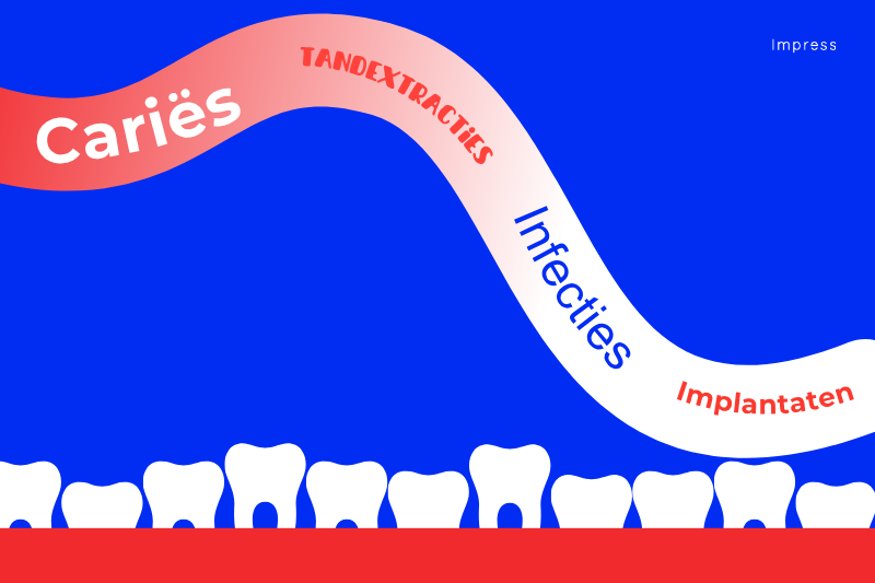 de weg naar caries in het Nederlands
