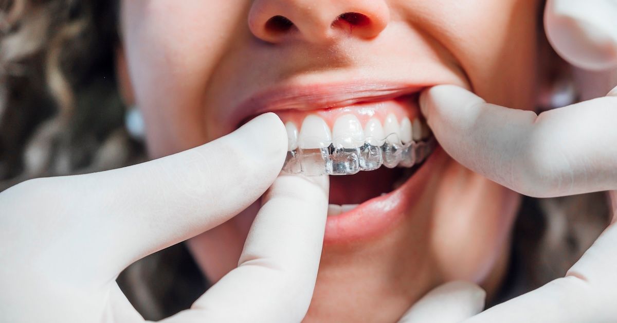 Woman receiving clear aligner therapy