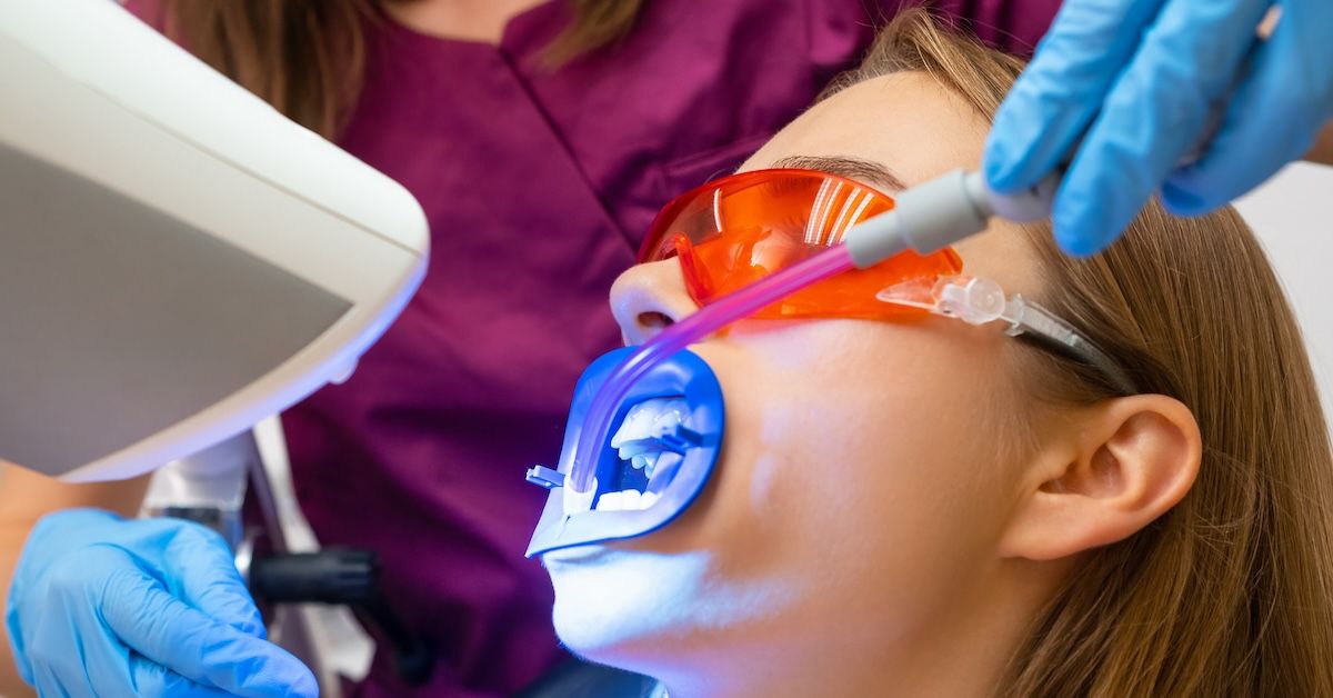 Teeth whitening: laser and LED. How do they work?
