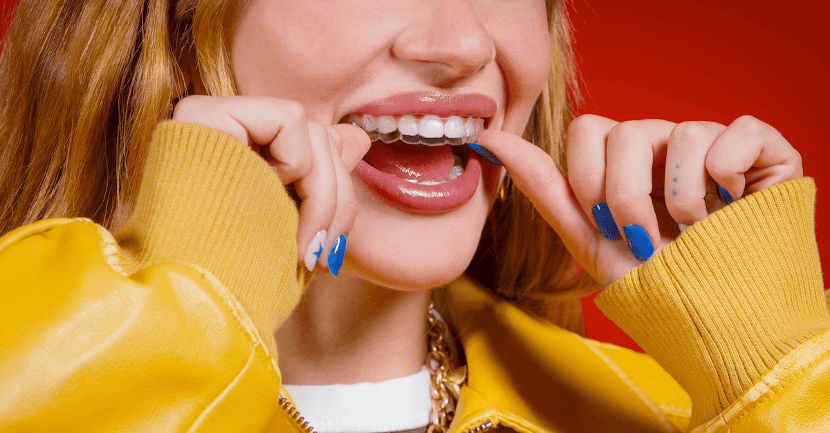La boca de una mujer que se pone unos alineadores invisibles Invisalign con una manicura azul.