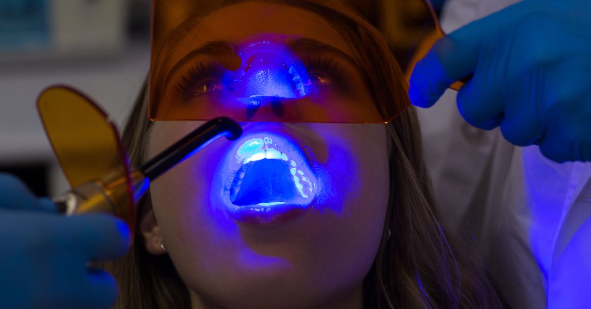 Mujer haciendo un blanqueamiento dental led en una clínica Impress.