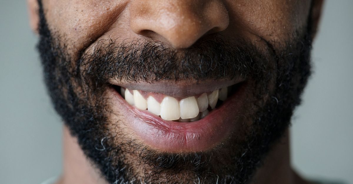 Dents qui se chevauchent causes et solutions 🦷