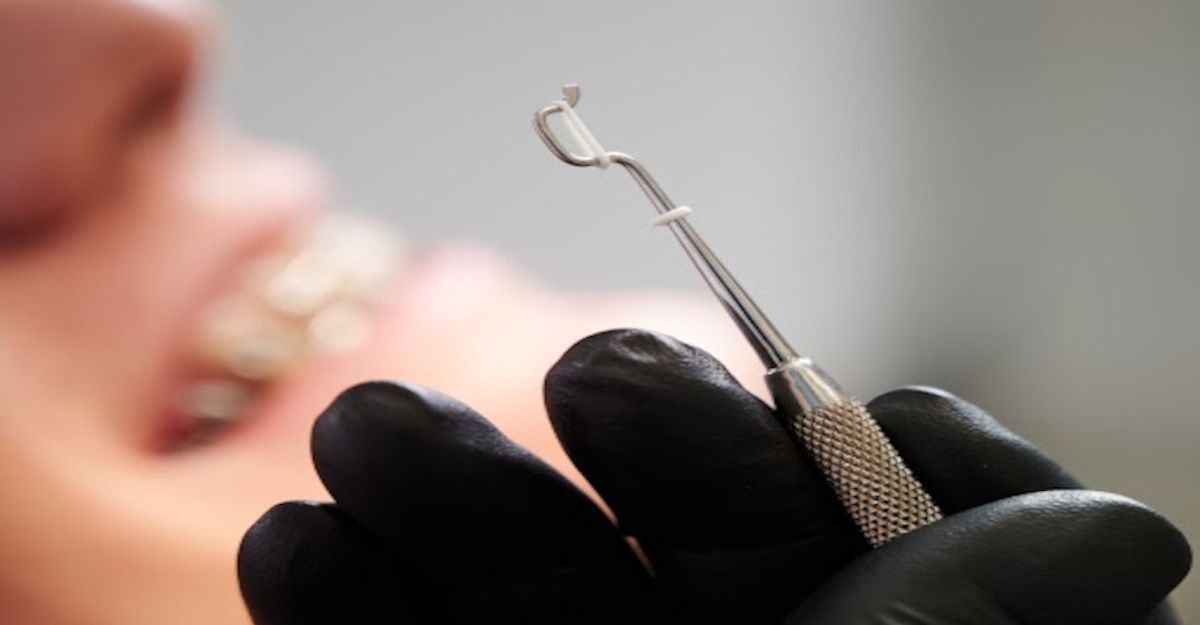 Orthodontic rubber bands for braces and aligners 🦷