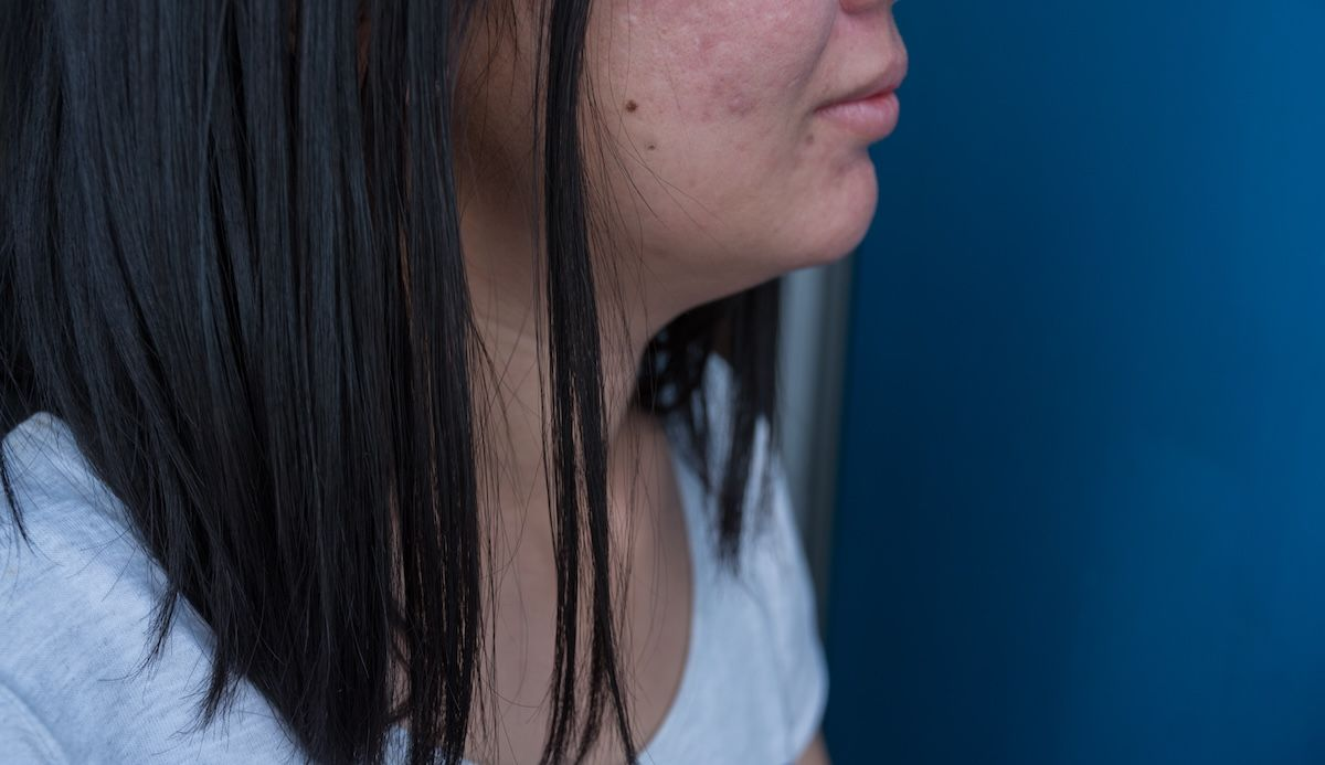 dunkelhaarige Frau mit einem fliehenden Kinn