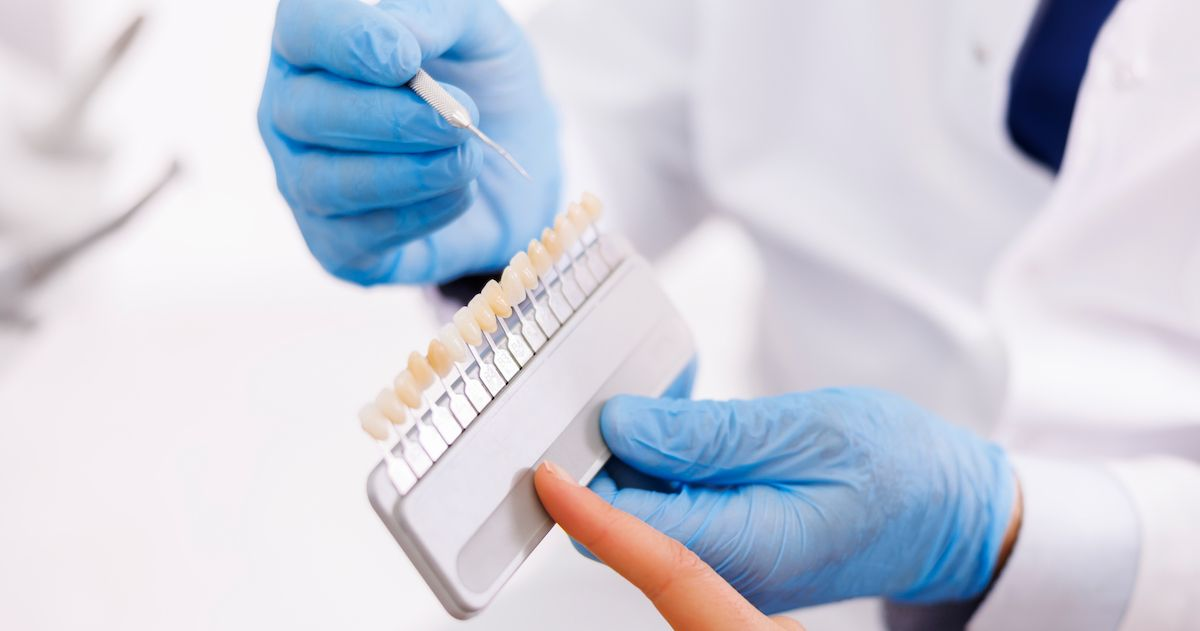 ein Zahnarzt zeigt die verschiedenen Farben von Zähnen anhand eines Modells