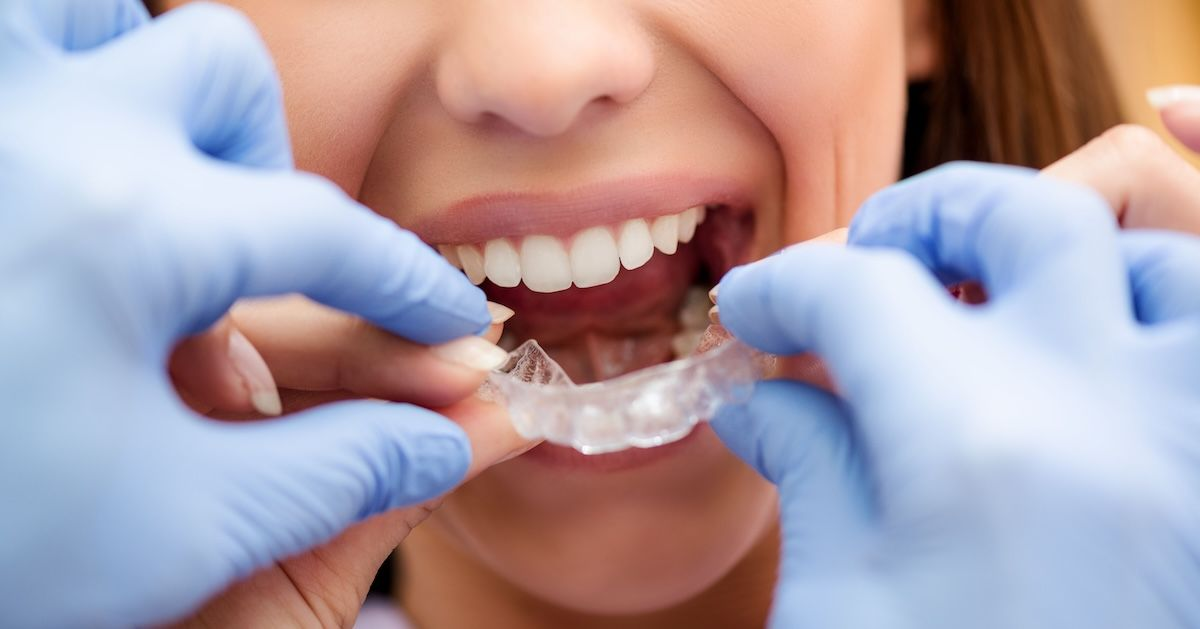 Zahnarzt setzt Patientin unsichtbare Zahnschi