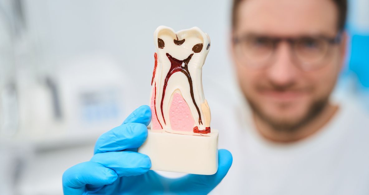 Een tandarts toont een model van een tand en de interne onderdelen ervan