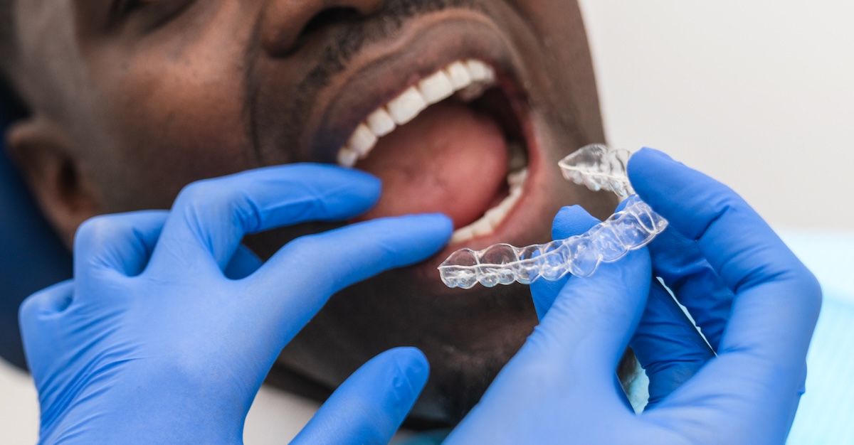 De orthodontist doet aligners in een mans mond