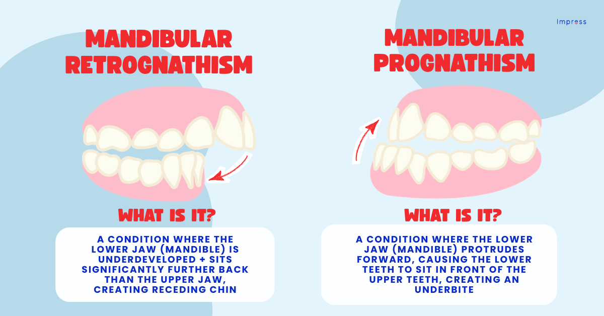 Infographic explaining differences in mandibular conditions