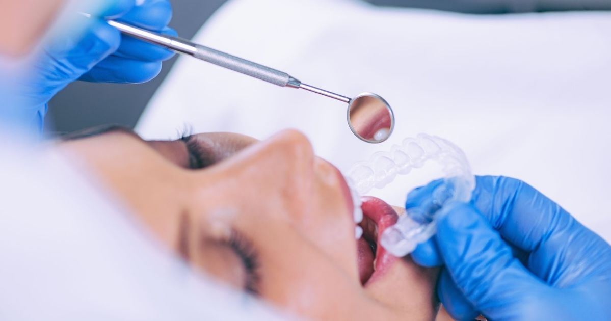 Een orthodontist controleert en past aligners bij een patiënt.