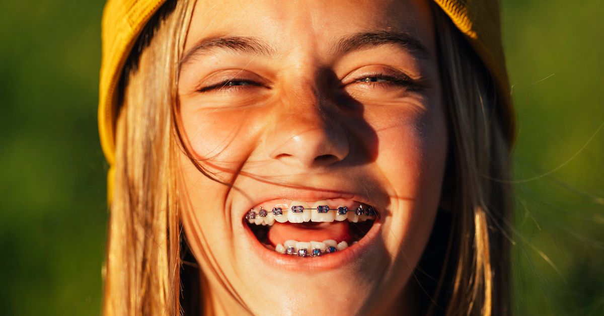 Una adolescente que sonríe y se le ven los brackets metálicos.