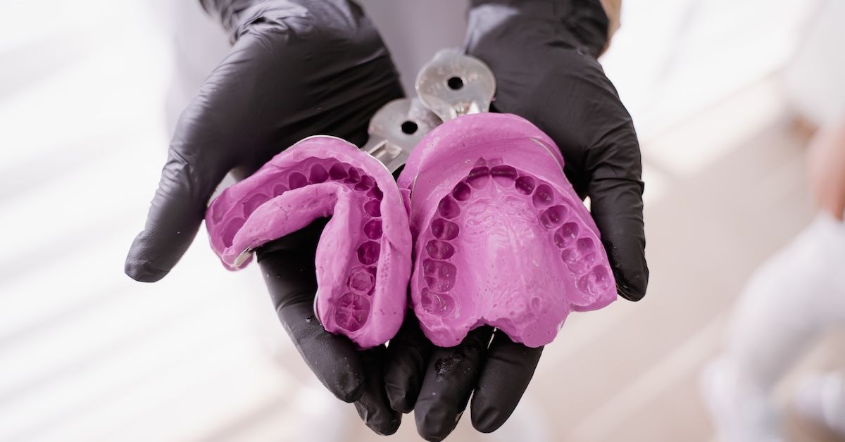 Two dental impression moulds made from aliginate