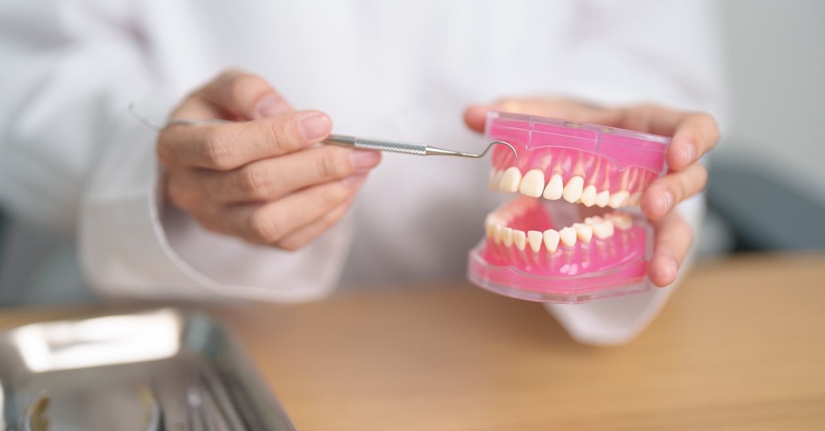 Model of a mouth, teeth and jaws held by a dentist