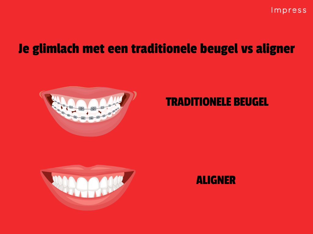 je lach met traditionele beugel en je lach met aligners