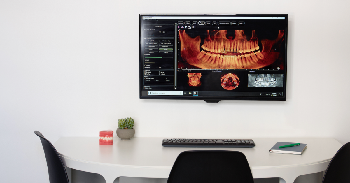 What are dental xrays and the different types? 🦷