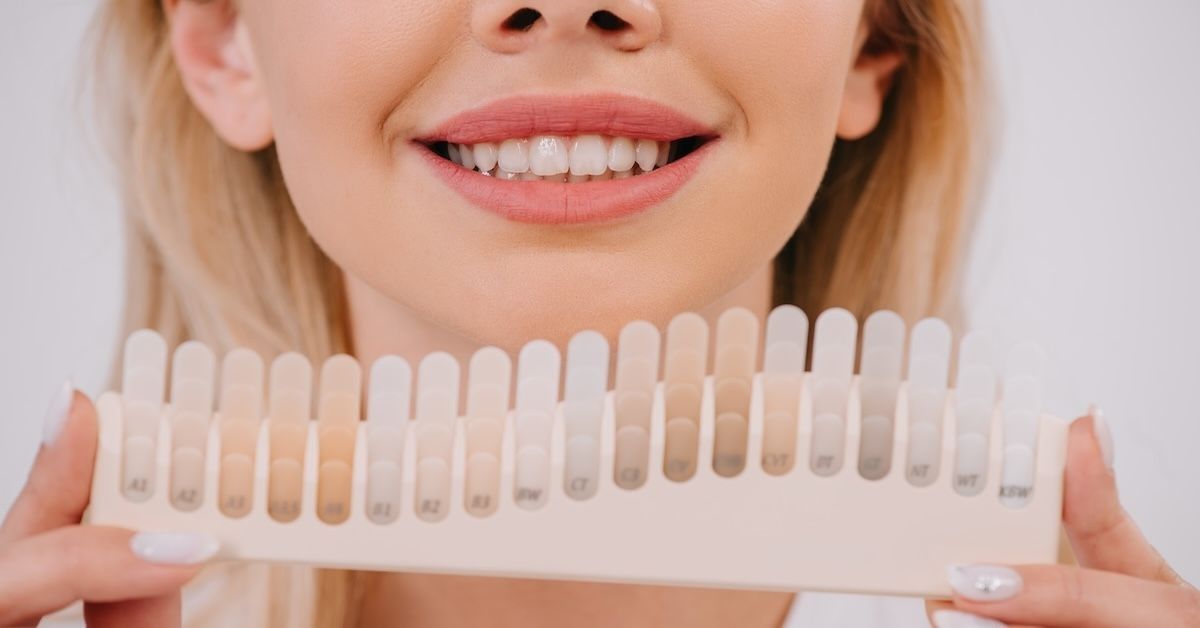 Een vrouw die een kleurkaart voor tandenbleken vasthoudt.