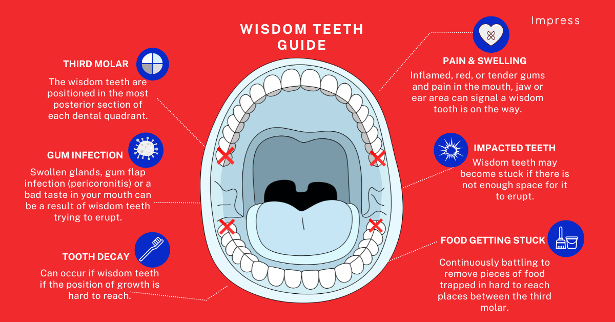 Infographic on wisdom teeth and the facts for removal