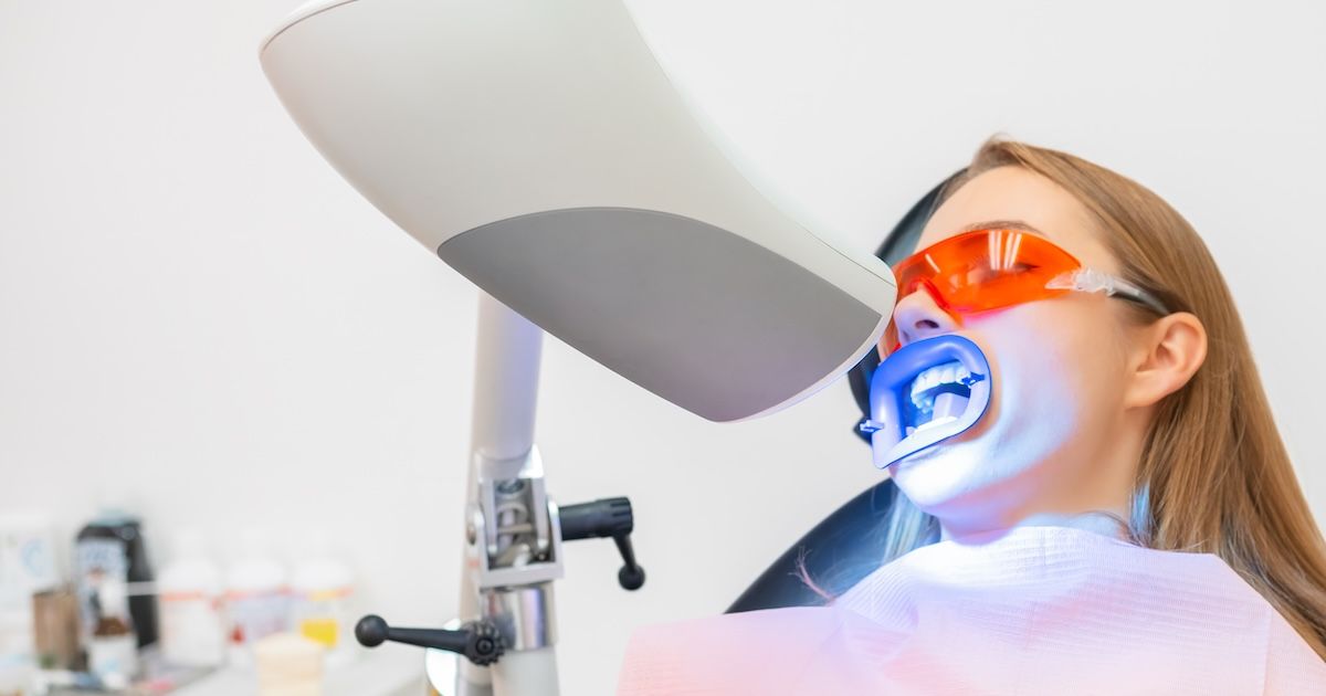 Vrouw die een LED-tandenbleekbehandeling ondergaat in een professionele kliniek.&nbsp;