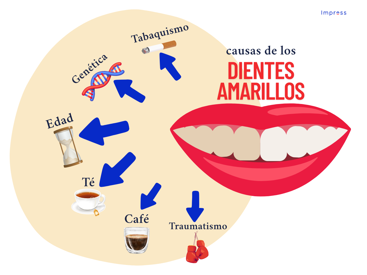 Infografía sobre las causas de los dientes amarillos.