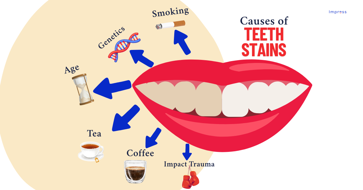 An infographic depicting the various causes for stains on teeth